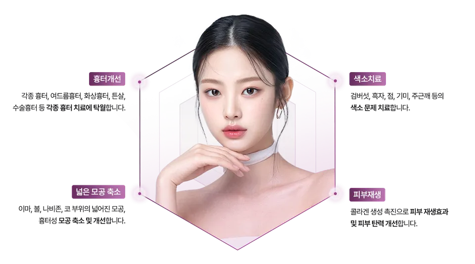 셀라스레이저 장점 이미지