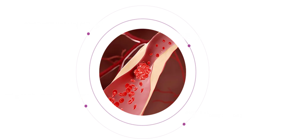 SVF 발기부전 치료 임상 실험 관련 설명 이미지