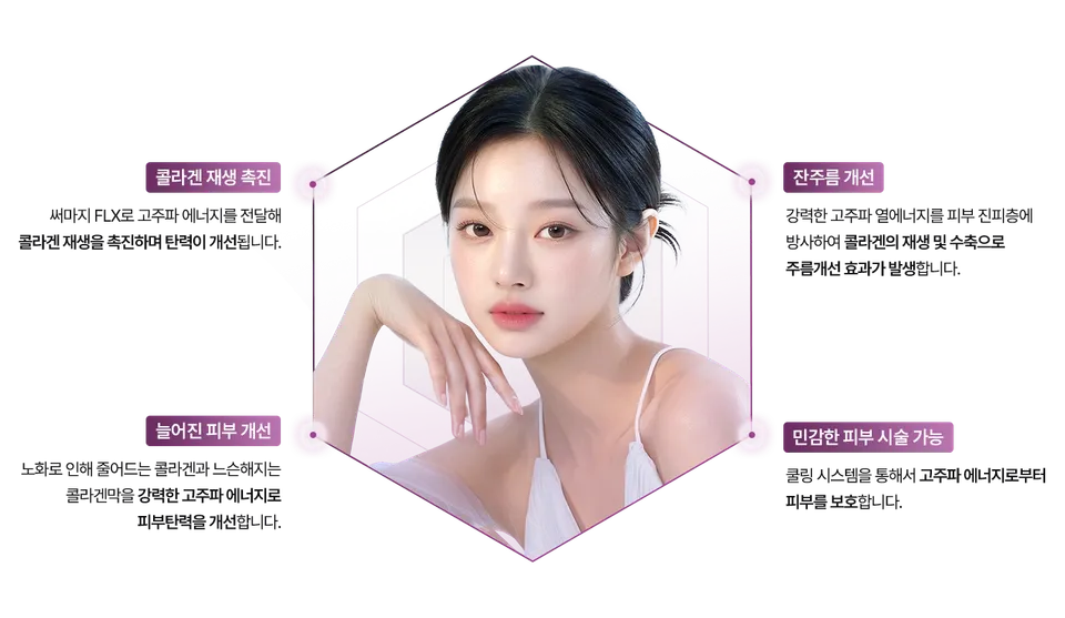 써마지 FLX 장점 이미지