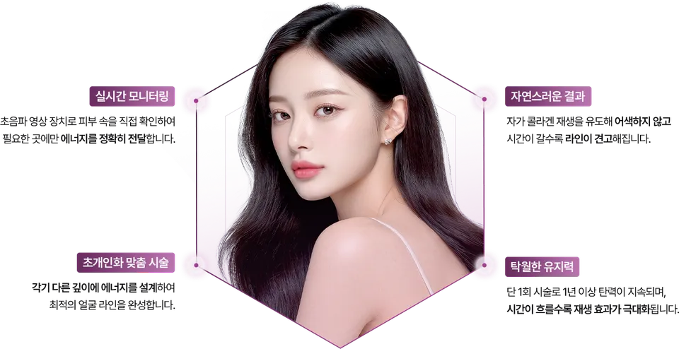 울쎄라피 프라임 장점 및 특징 이미지